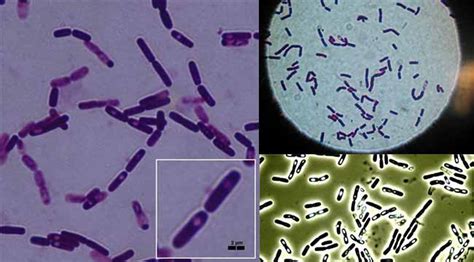 Bacillus cereus- An Overview - Microbe Notes