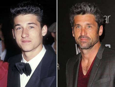 Patrick Dempsey Plastic Surgery: Before and After Analysis ...