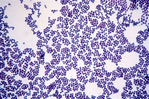 Gram positive vs gram negative cluster - rekaeastern