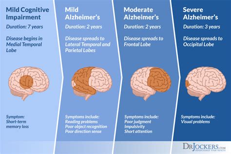 Alzheimer’s and research on a possible cure? | Communicating Science ...