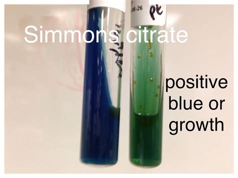 Simmons Citrate Agar test positive is blue or green with growth ...