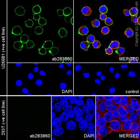 Recombinant Anti-CD28 antibody [EPR24592-5] (ab283860) | Abcam