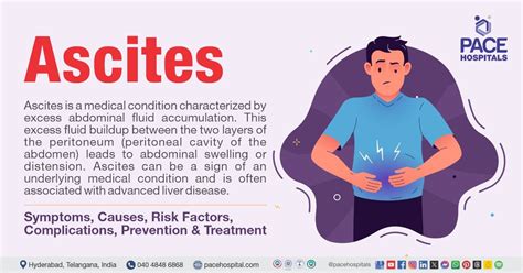 Ascites - Symptoms, Causes, Complications, Prevention, Treatment