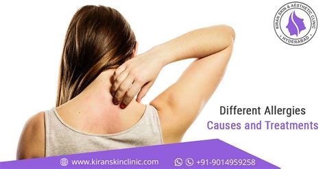 Skin allergies treatment in hyderabad | Kiran Skin Clinic