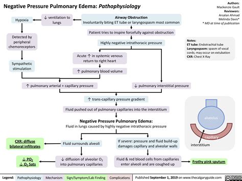 Negative Pressure Pulmonary Edema: Pathophysiology | Calgary Guide