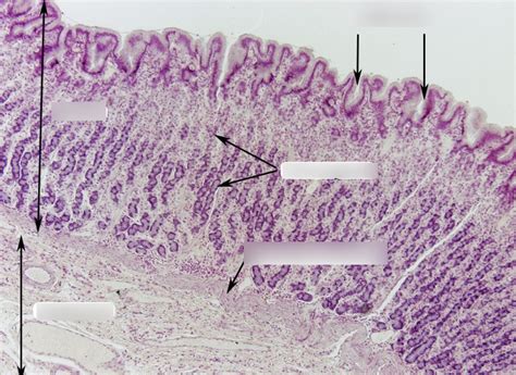 Digestive lab - stomach slide Diagram | Quizlet