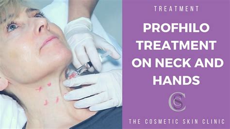 Profhilo Treatment On Neck and Hands | The Cosmetic Skin Clinic - YouTube