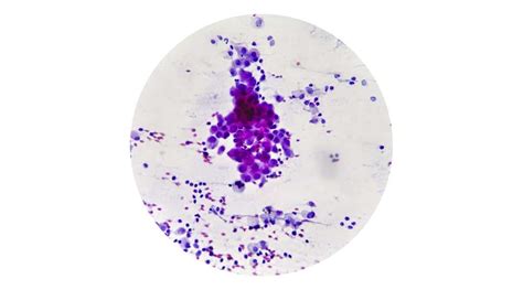 Fibrosarcoma In Dogs: Symptoms, Diagnosis, Treatment & Prognosis - Petsynse