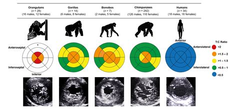 Divergent evolution of the human heart: What we can learn from our ...