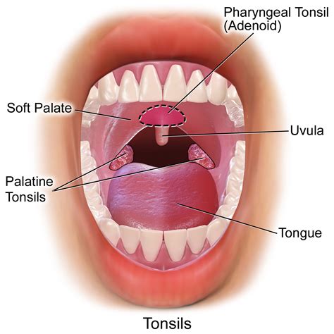 Tonsil Removal (Tonsillectomy)