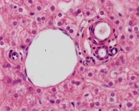 Liver Portal Triad Histology