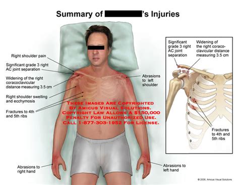 Medical Exhibits, Demonstrative Aids, Illustrations and Models