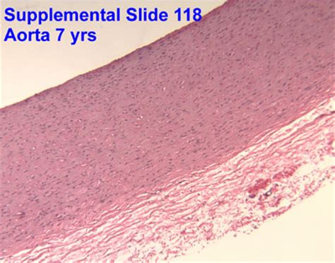 Aorta Slide Histology