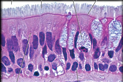 Ciliated Simple Columnar Epithelium Location - Goimages Signs