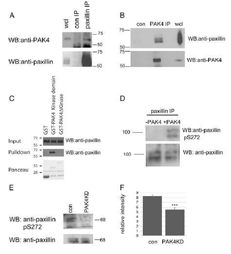 PAK4 phosphorylates paxillin at serine 272. (A) Endogenous paxillin was ...