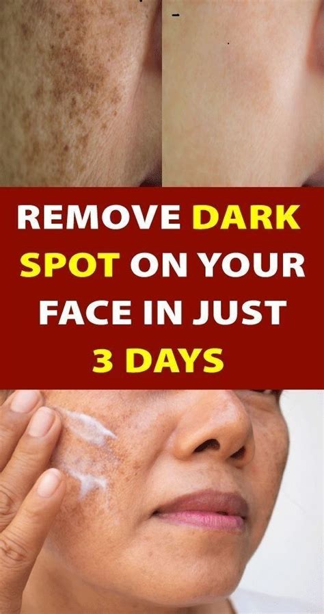 Use these 2 ingredients to help eliminate wrinkles, dark spots and crow ...