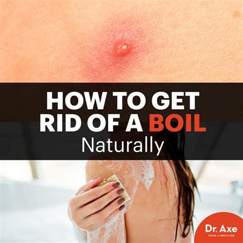 Holistic Health Transformation: How to Get Rid of a Boil