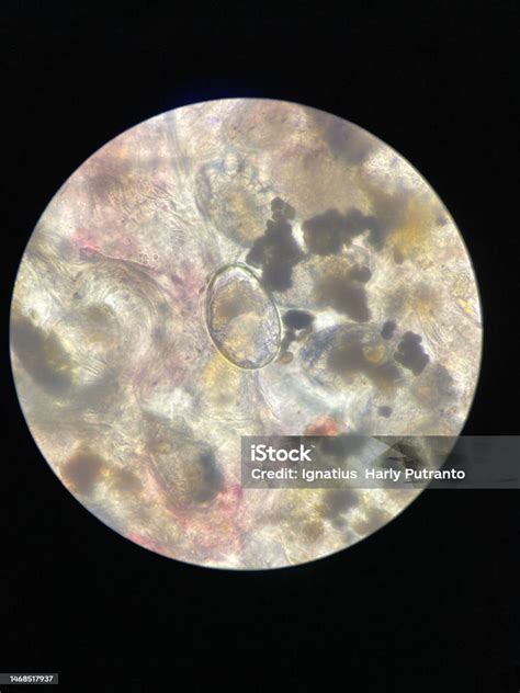 Scabies Notoedres Egg Under The Microscope Stock Photo - Download Image ...