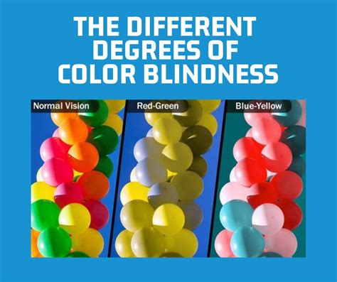 The Different Degrees of Color Blindness | Florida Eye Microsurgical ...