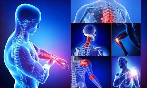 Artróza nebo artritida? | MUDr. Picek, ortoped, traumatologm operatér