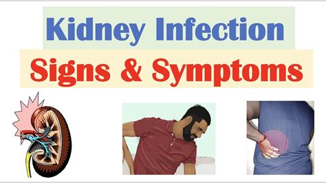 Kidney Infection (Pyelonephritis) Signs & Symptoms | & Why They Occur ...