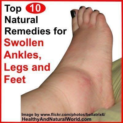 Researchers Explain the Causes of Swollen Legs, Ankles and Feet + How ...