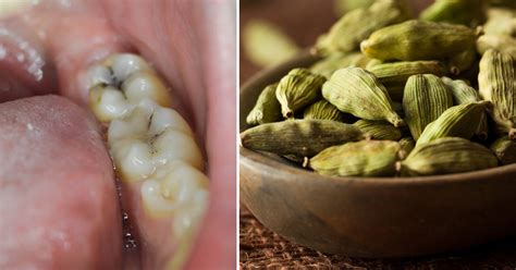 Cardamom Benefits: 7 Ways This Spice Can Improve Your Life