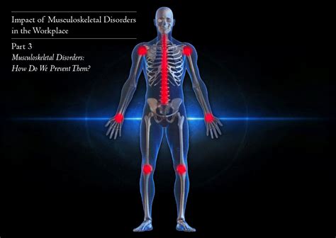 Musculoskeletal Disorders: How Do We Prevent Them?