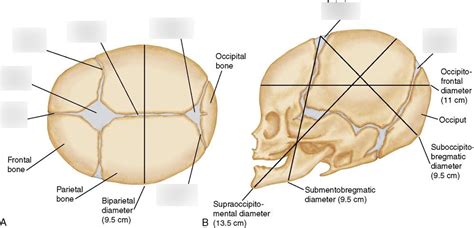 Fetal Fontanelles Diagram | Quizlet