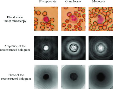 Leukocytes Microscope