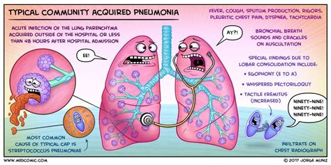 Learn typical community acquired pneumonia with a Medcomic | Community ...