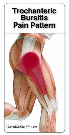 The Truth About Bursitis Pain. - Back in Motion PT - Sarasota Physical ...