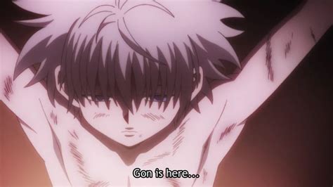 Killua | Hunter x hunter, Anime, Killua