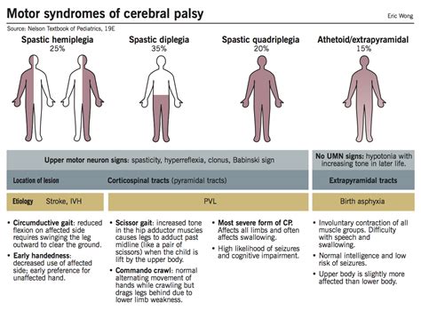 Clinical types of CP – McMaster Pathophysiology Review