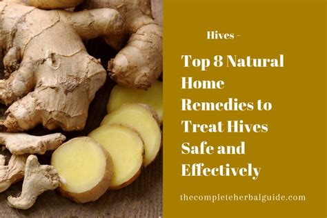 8 Ways to Get Rid of Hives - Health and Natural Healing Tips