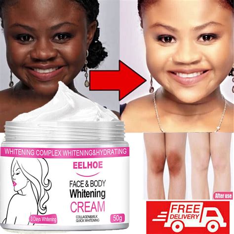 Skin Bleaching Products For Black Skin