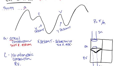 Central Venous Pressure Acv Xy Waves