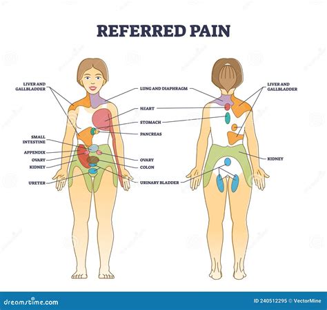 Referred Pain Location As Body Painful Stimulus Organ Origin Outline ...