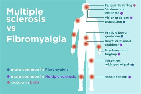 What symptoms are different between fibro and ms? : r/Fibromyalgia