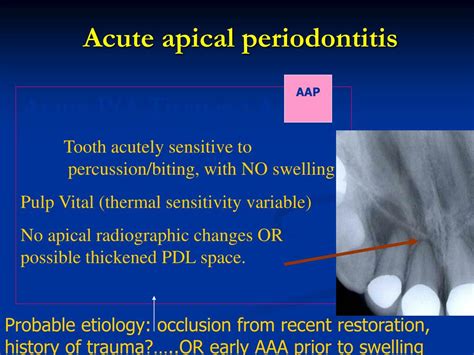 Apical Periodontitis Vs Apical Abscess