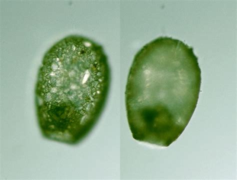 Protist Images: Difflugia