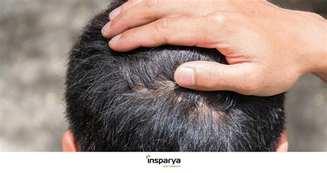 Itchy and painful irritated scalp - Solutions | Insparya Hair Clinic