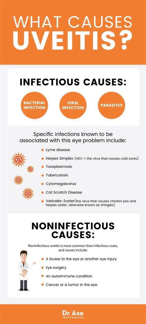 Uveitis causes - Dr. Axe | Uveitis, Eye health, Health