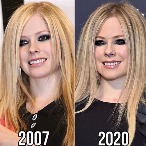 Avril Lavigne Teeth Fixed