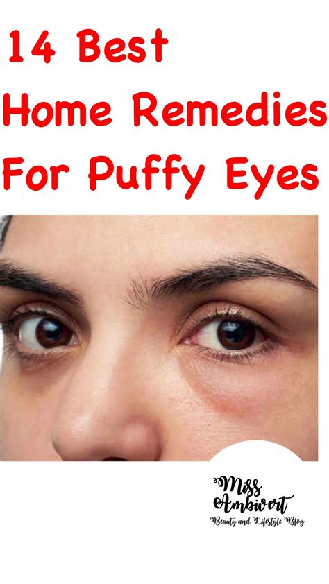 puffy eyes fix exactly how to obtain rid, root causes of symptoms and ...