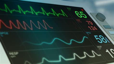 How to Read a Patient Monitor: Numbers and Lines Explained