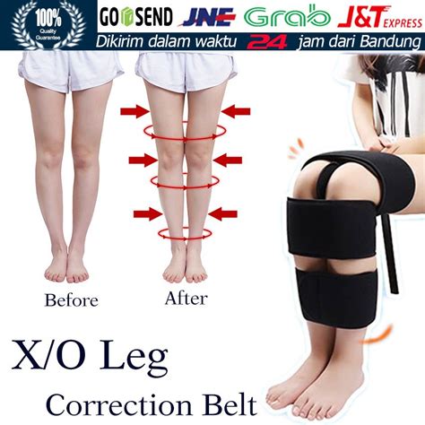 3Pcs O/X Legs Correction Braces Bandage Knock knee Bowlegs Orthotic ...