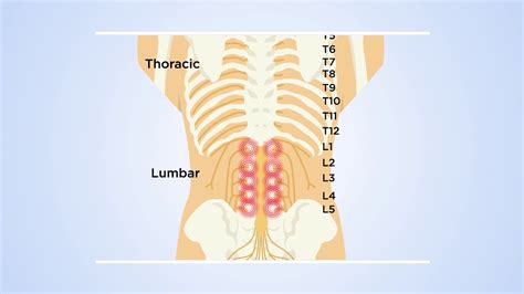 How DRG stimulation at T12 reveals the transmission of low back pain in ...