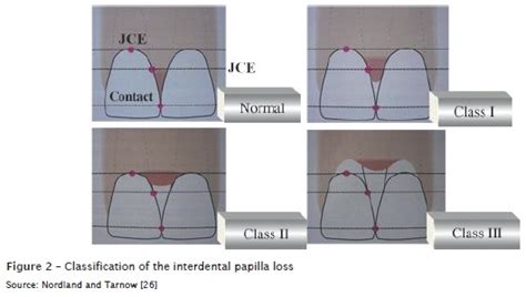 Papillary regeneration: anatomical aspects and treatment approaches