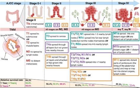 Ajcc Rectal Cancer Staging